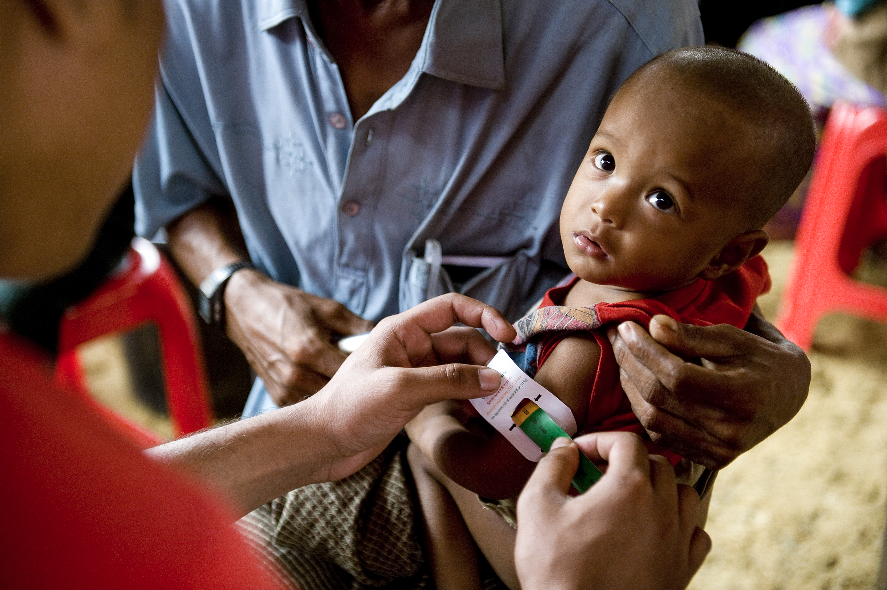 A child is tested for malnutrition with a MUAC band
