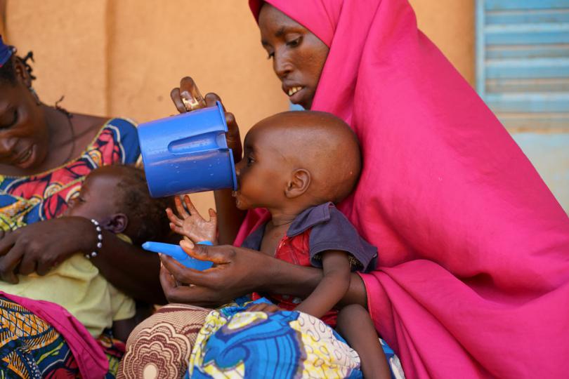 Oumar, one, is being treated at Aguie hospital, Niger. Oumar has just turned 1 year old. He and his mother Mariam live in Nigeria, but the Aguie hospital in Niger is the closest hospital to their home.