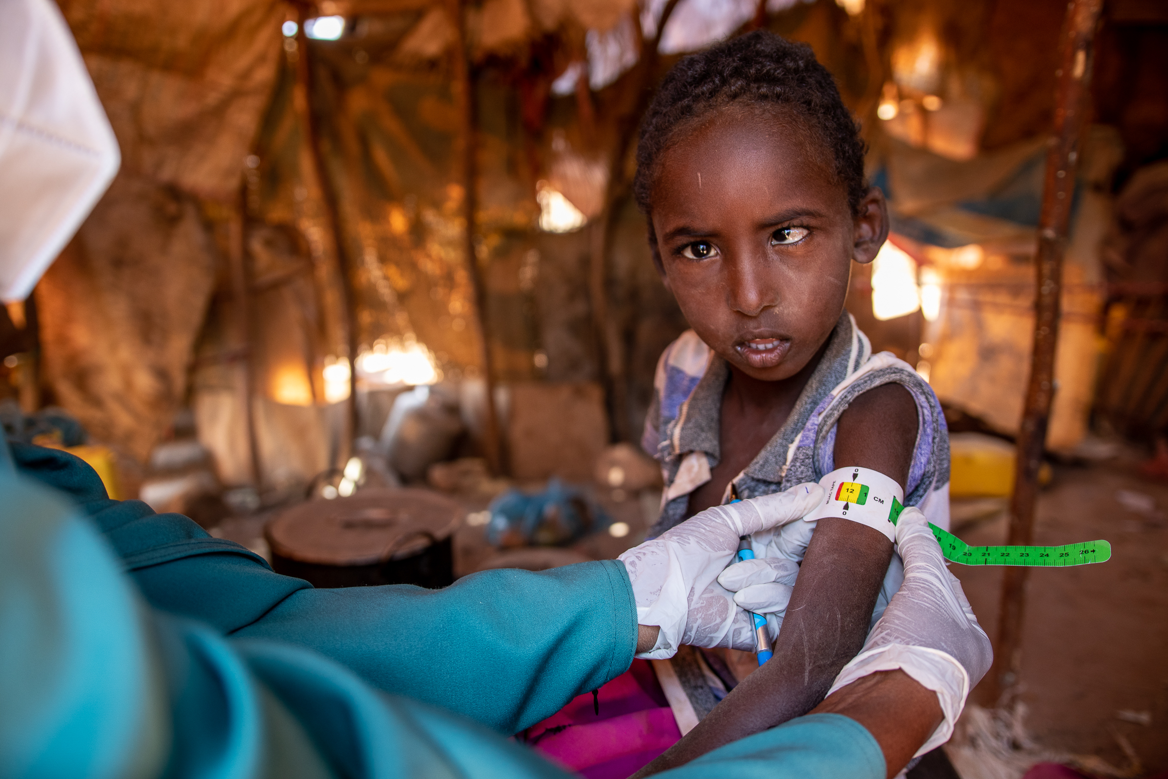 Muna checks a child for malnutrition