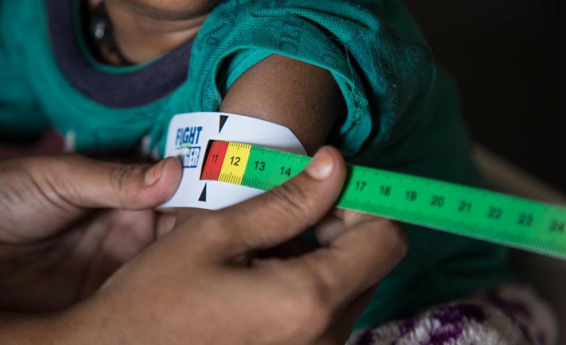 A child getting tested for signs of malnutrition