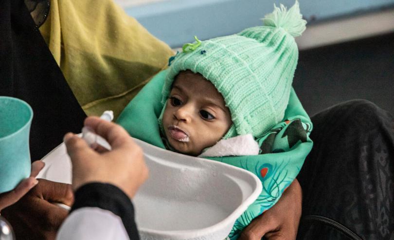Haifa*, 11 months, is held by her mother as she gets treatment at the therapeutic feeding centre, Taiz, Yemen