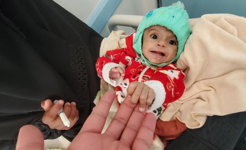 One year old Haifa* is held by her mother Roqea* as she is treated for malnutrition. Sami Jassar/Save the Children