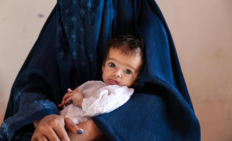 Mother and child in a health clinic getting treatment for severe acute malnutrition, hunger, Afghanistan 