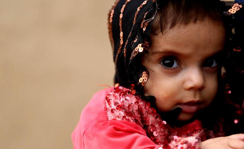 Ara*, 18 months, who is severely malnourished, is held by her mother Fatima*, 21