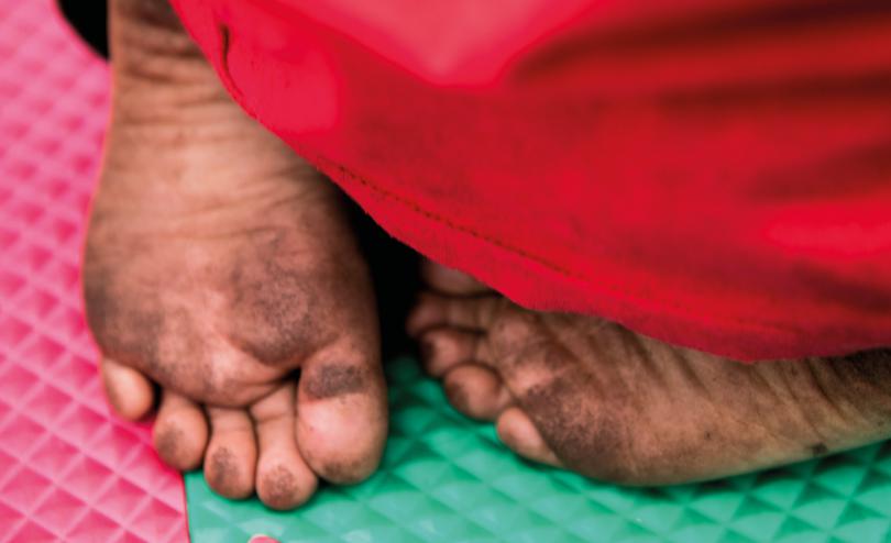 Image of a migrant child's feet