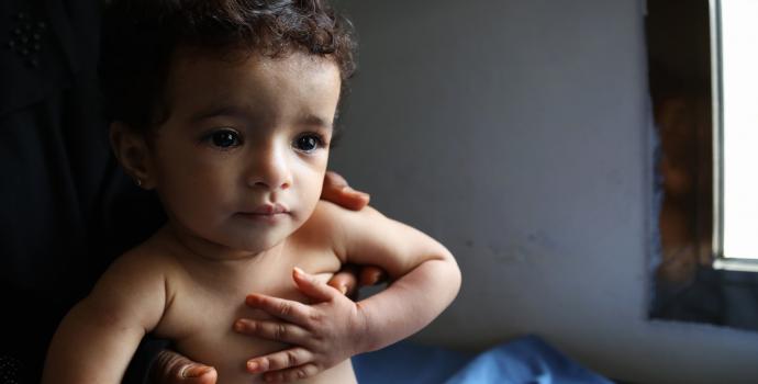 Arwa*, 15 months is assessed at the health clinic where she is found to be suffering from malnutrition