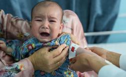 Baby Firoz has malnutrition in Afghanistan 