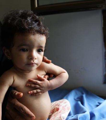 Yemen Crisis
